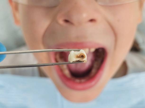 Best Weekend Emergency Dentist in Seadrift, TX