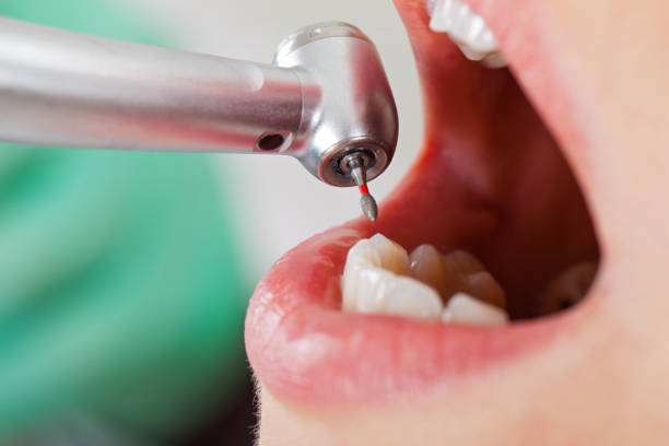 Best Emergency Dentist for Lost Fillings or Crowns in Seadrift, TX